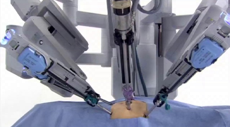 robotic surgery for prostate cancer in india