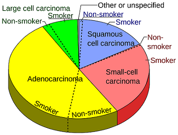 Lung Cancer Risk Factors