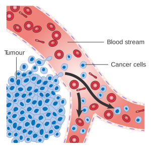 blood cancer treatment in India