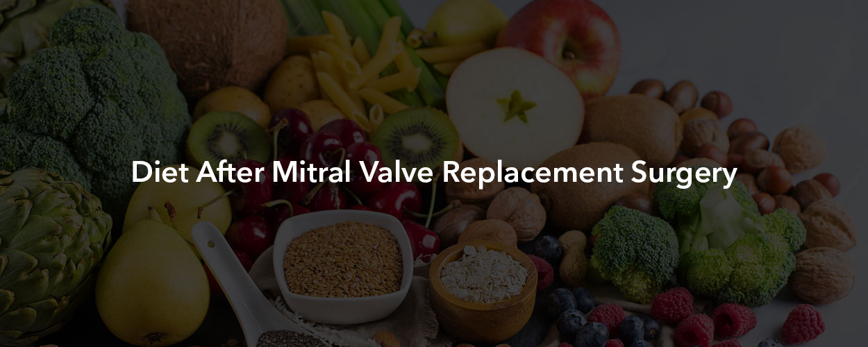 Diet After Mitral Valve Replacement Surgery