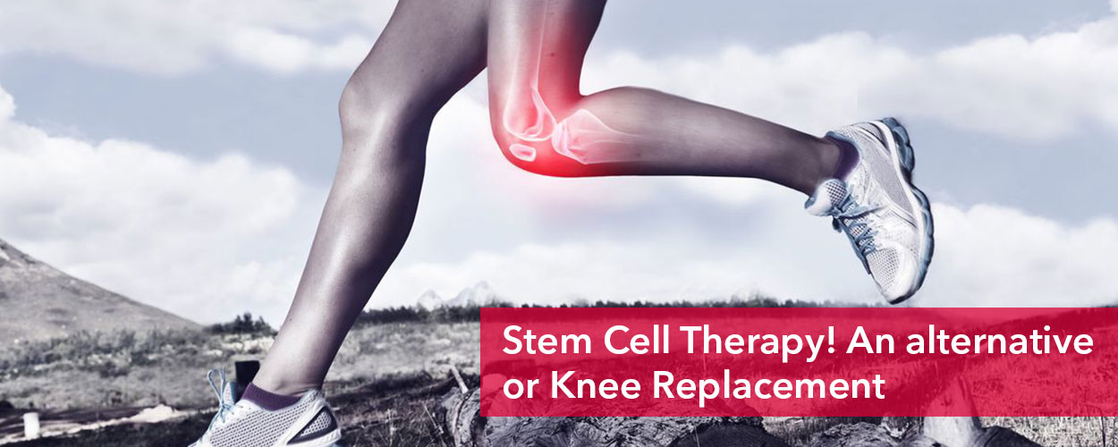 Stem Cell Therapy for Knees