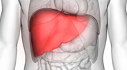 Liver Transplant Success Rate in India