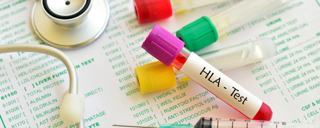 HLA Test – Human Leukocyte Antigen