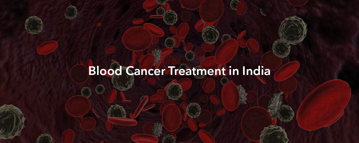 How Much Does Blood Cancer Treatment Cost?