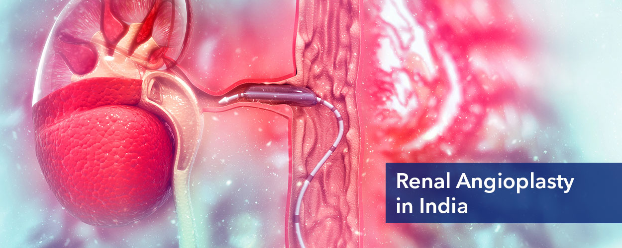 Renal Angioplasty in India