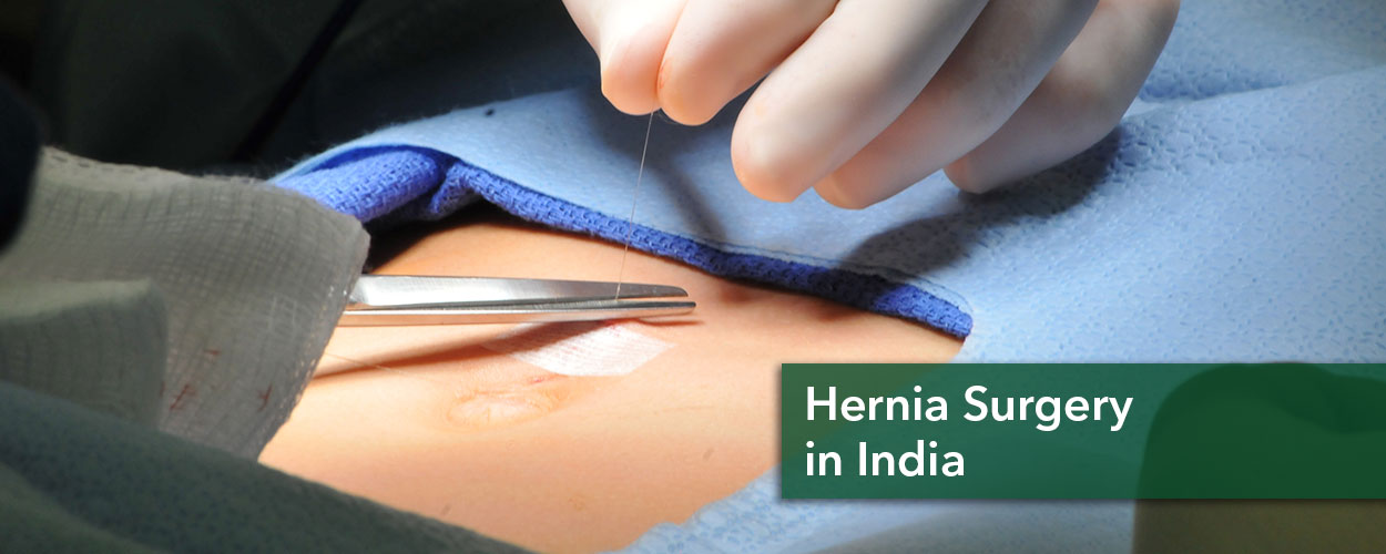Hernia Repair in India