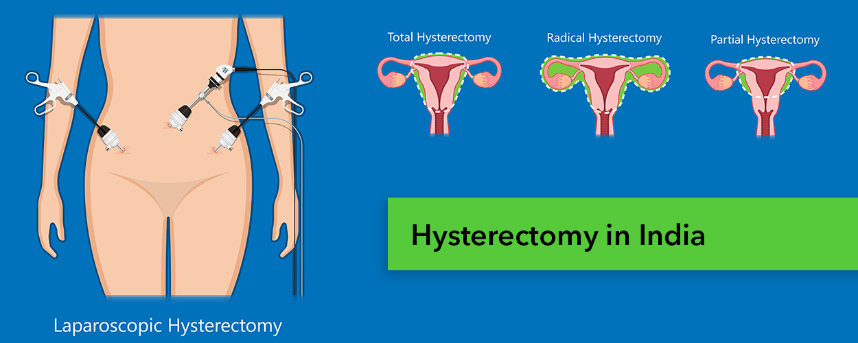 Hysterectomy in India