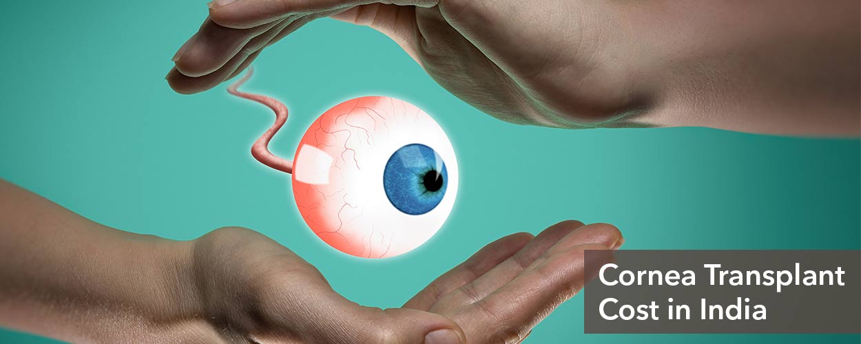 How Much Does A Cornea Transplant Cost?