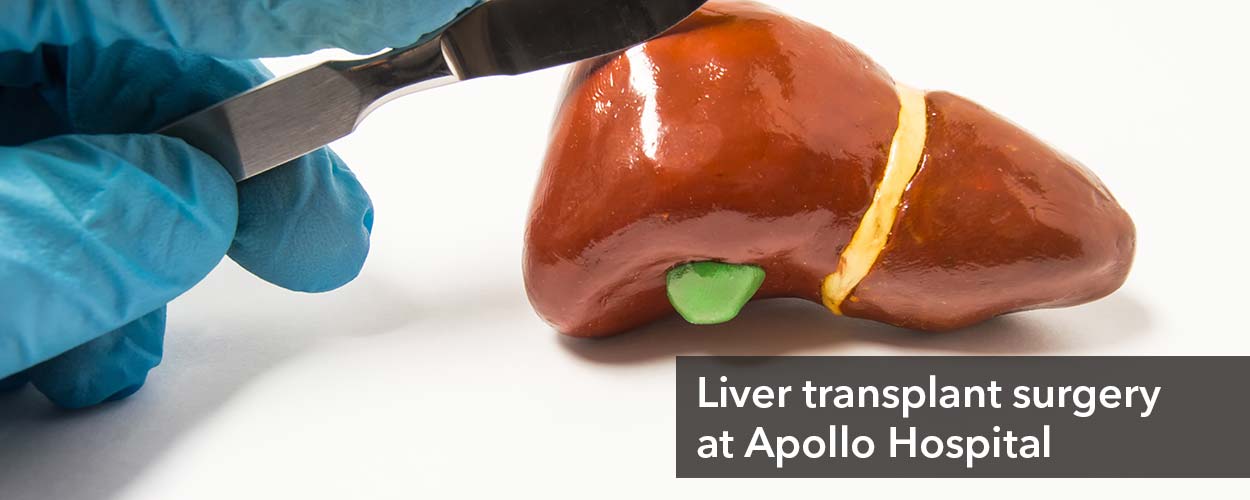Liver transplant cost in Apollo
