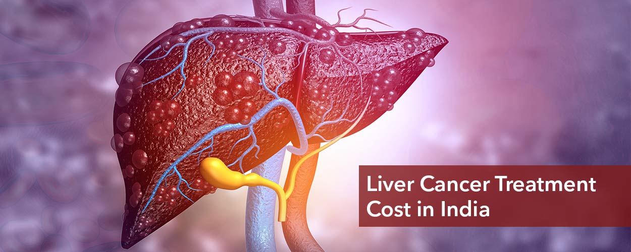 Liver Cancer treatment in India