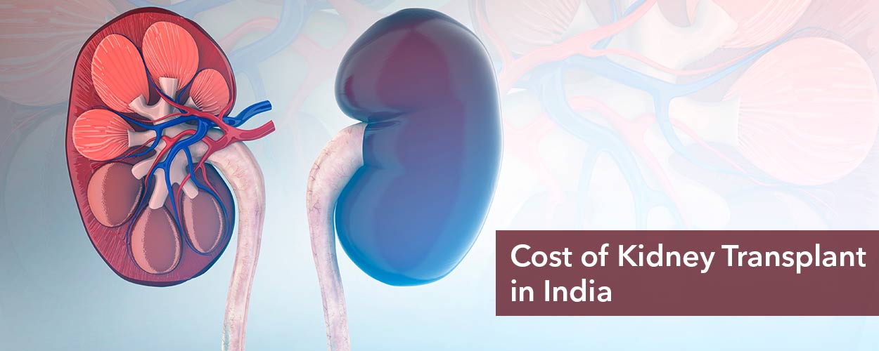 Kidney Transplant Cost in India