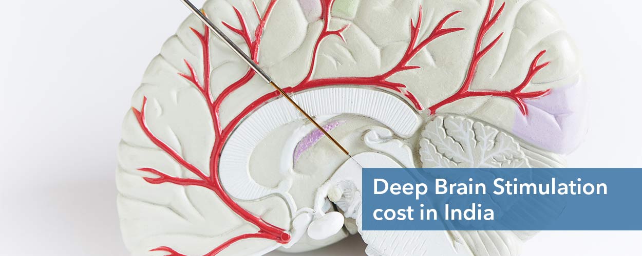 Dystonia Treatment Cost in India