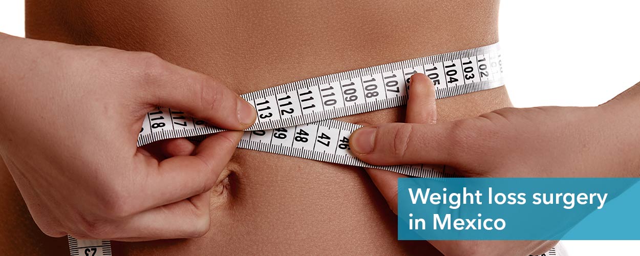 weight-loss-surgery-Mexico