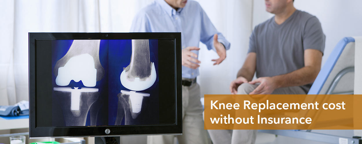 Knee Replacement Cost Without Insurance