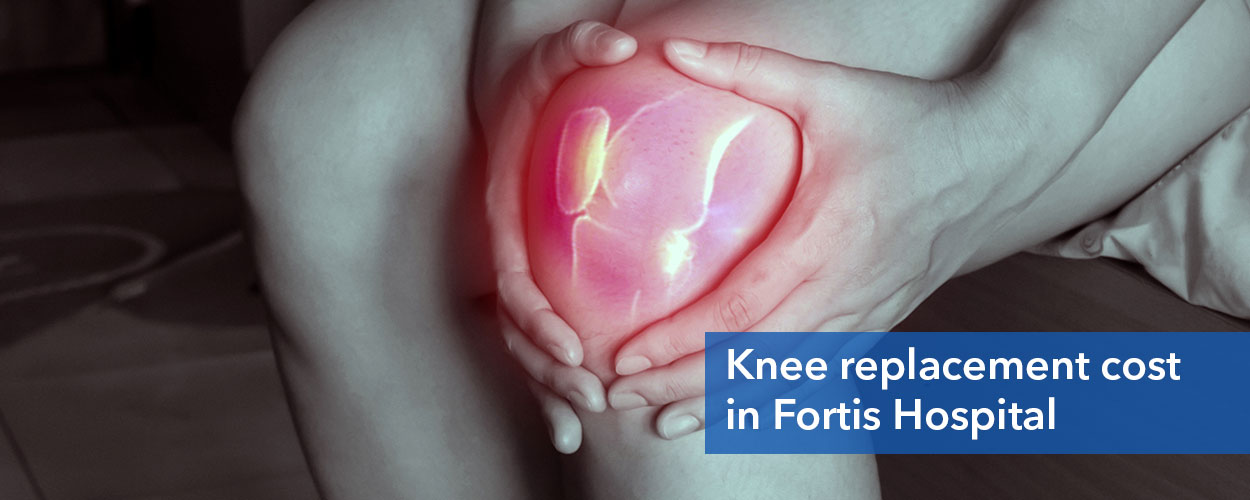 Knee Replacement Surgery Cost in Fortis