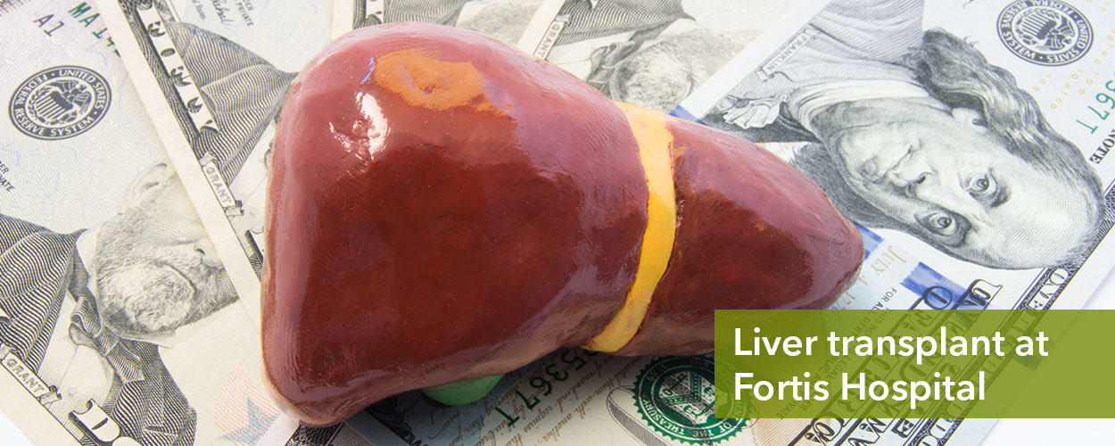 Liver Transplant Cost in Fortis Hospital