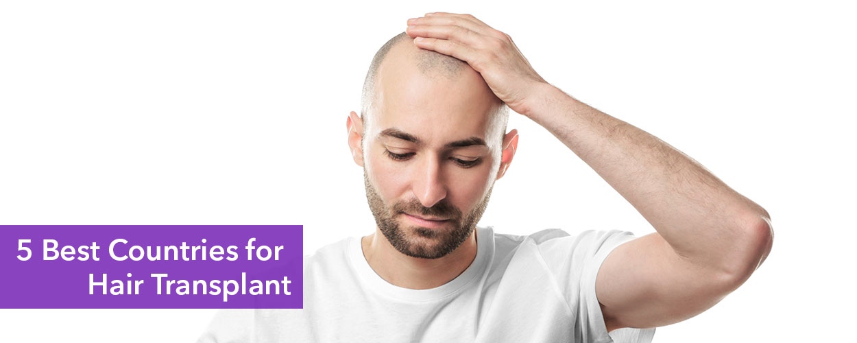 5 Best Countries for Hair Transplant