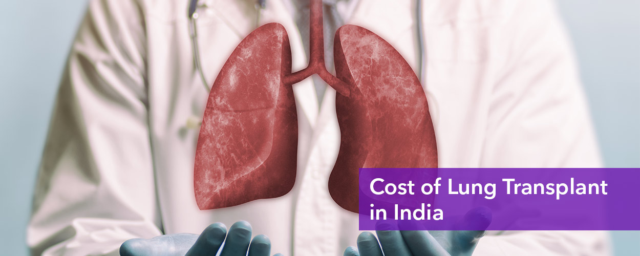 Lung transplant cost in India