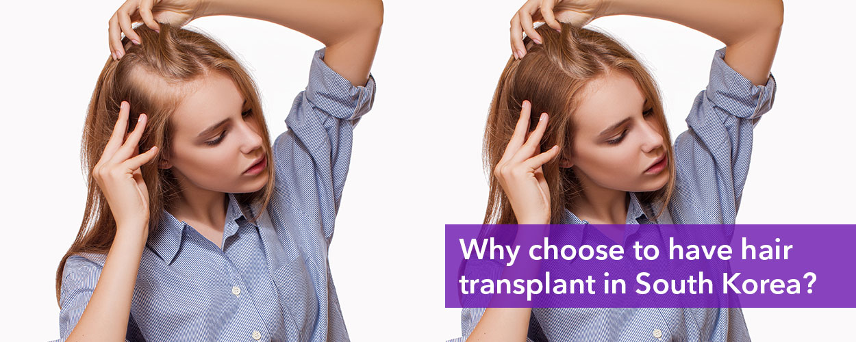 Why choose to have hair transplant in South Korea