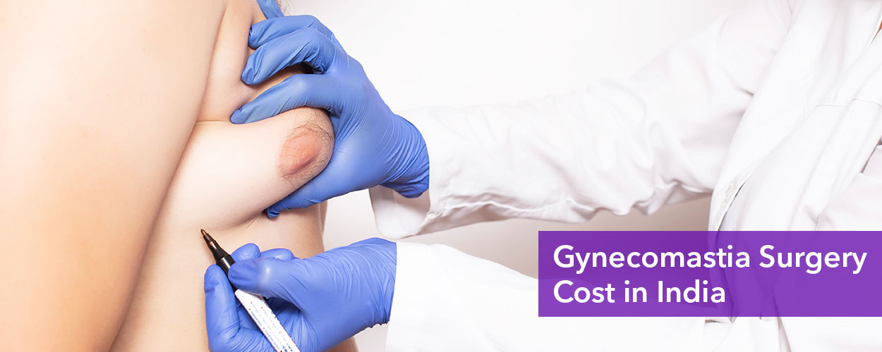 Gynecomastia Surgery Cost in India