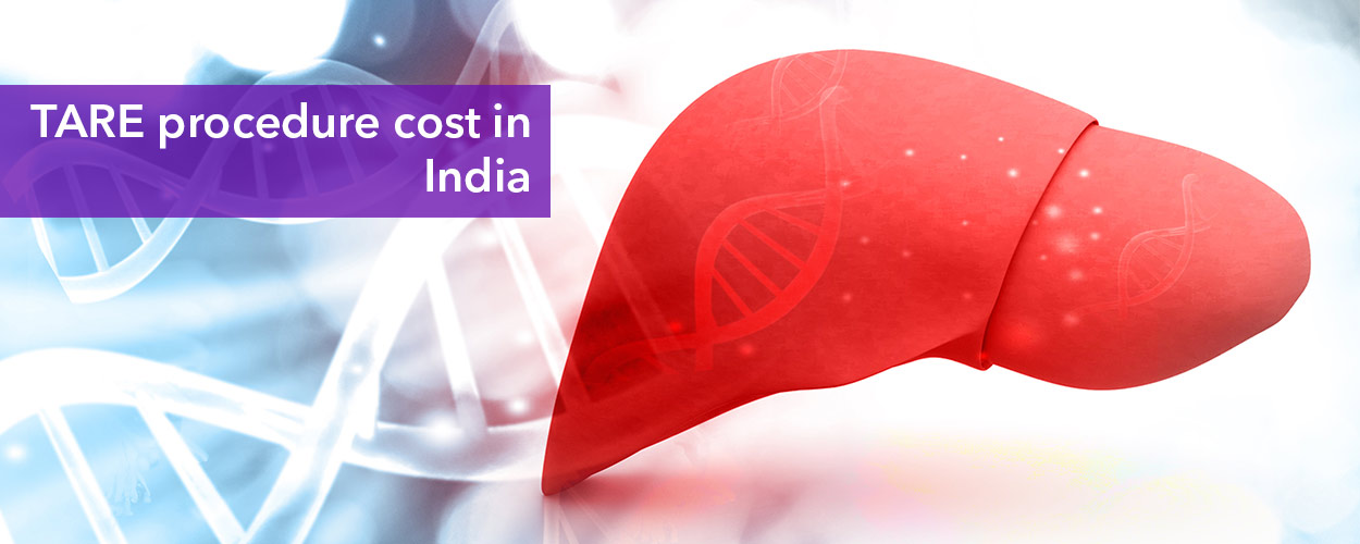 TARE procedure cost in India