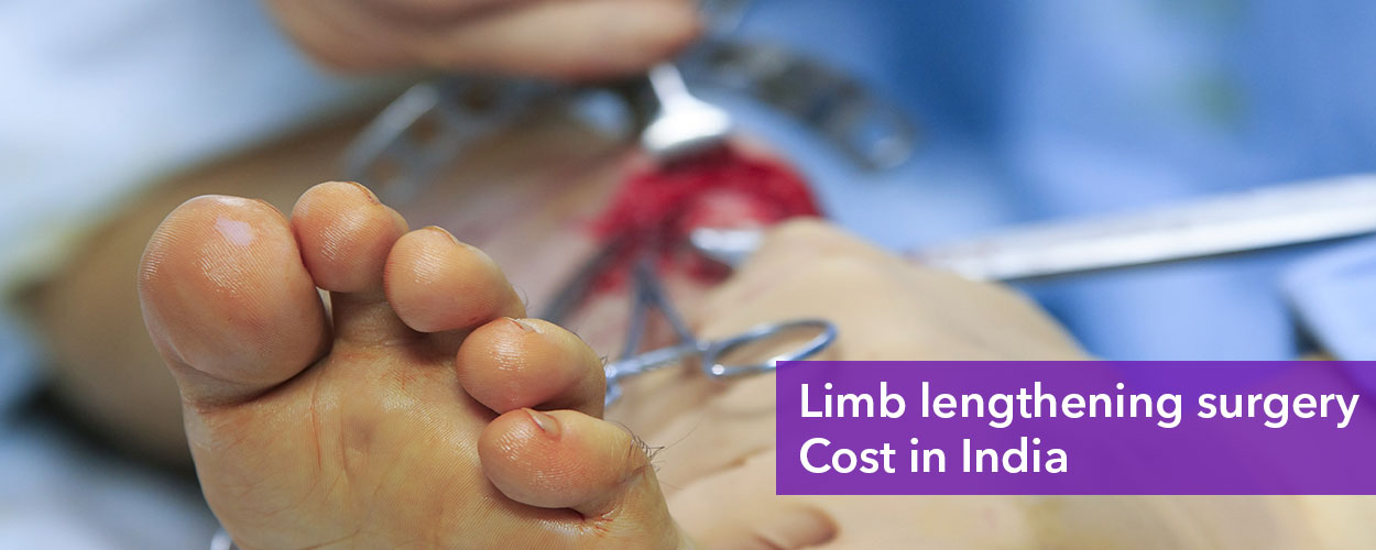 Limb Lengthening Surgery Cost in India