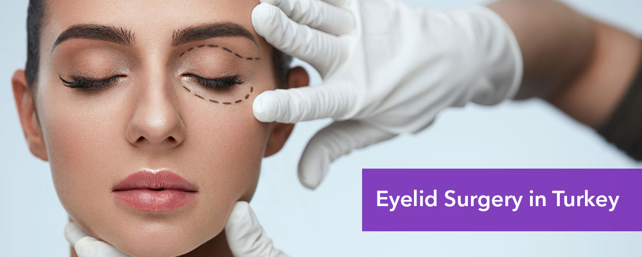 eyelid-surgery-cost-in-Turkey